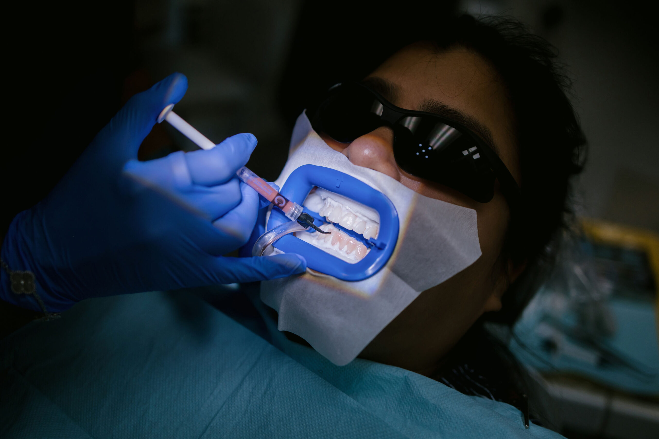 a person getting their teeth whitened at Manhattan Dental Spa