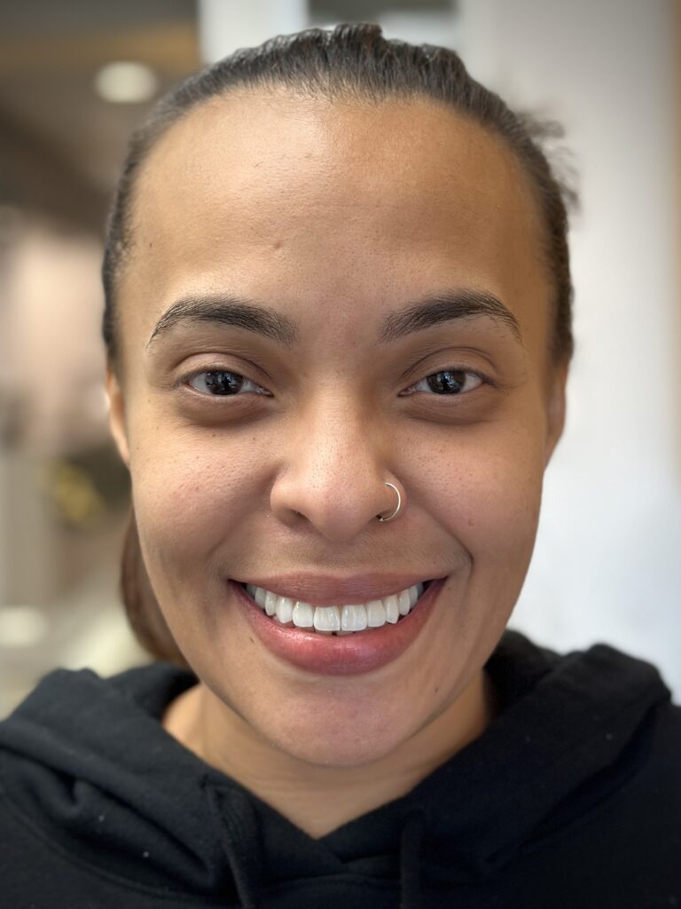 close up of patient after dental implants